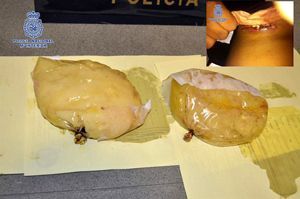 Cocaine stuffed breast implants